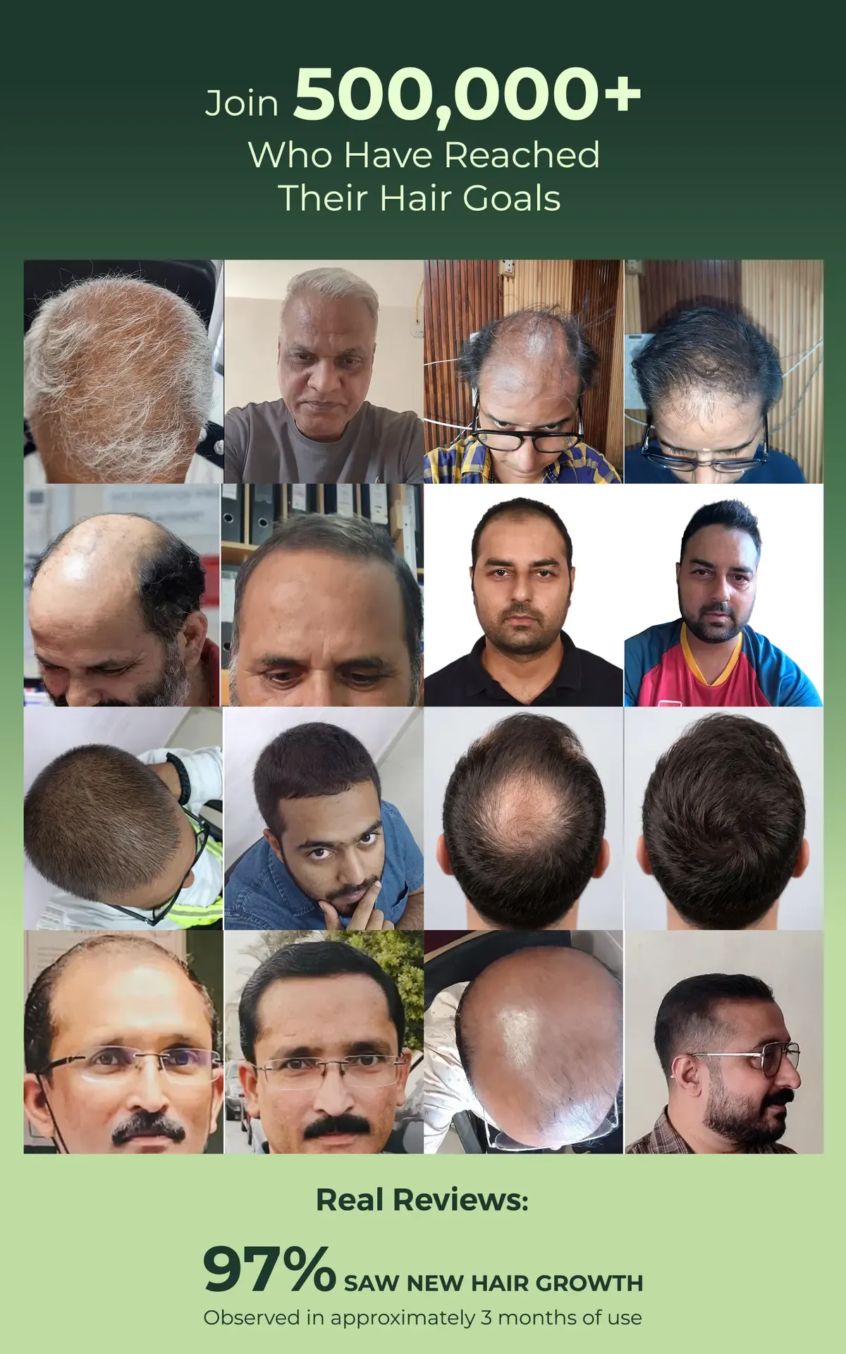 Real results Before and after hair regrowth results grid from 500,000+ Green Wealth customers — 97% saw new hair growth in about three months