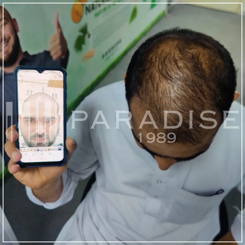 Verified review — Arun K. Verified customer photo review by Arun K. for Green Wealth Neo Hair products