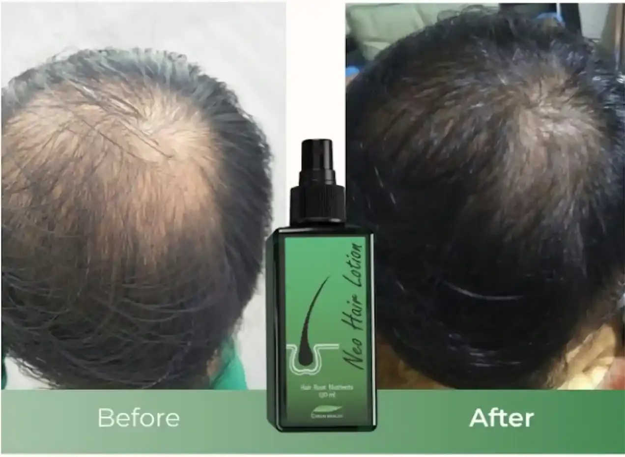 Verified customer photo review by Yousaf Ali for Green Wealth Neo Hair products