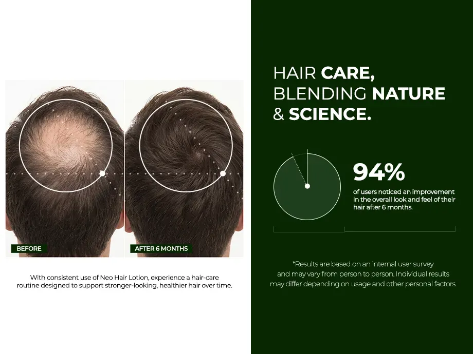 Neo Hair Lotion banner comparing the botanical formula with pharmaceutical alternatives