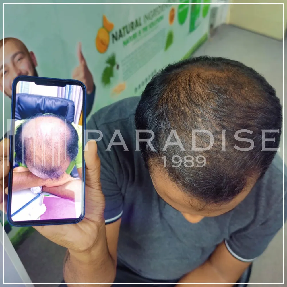 Verified review — Hassan B. Verified customer photo review by Hassan B. for Green Wealth Neo Hair products