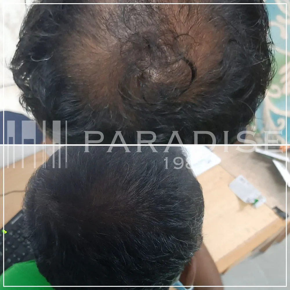 Verified review — Omar H. Verified customer photo review by Omar H. for Green Wealth Neo Hair products