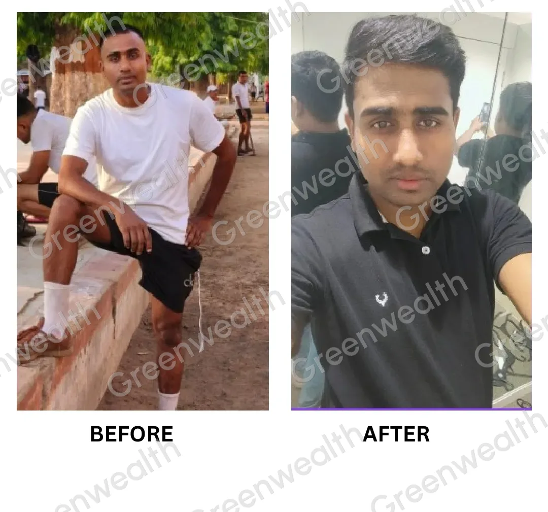 Before and after: a close-cropped, receding hairline, then a fuller, longer front hairline (2)