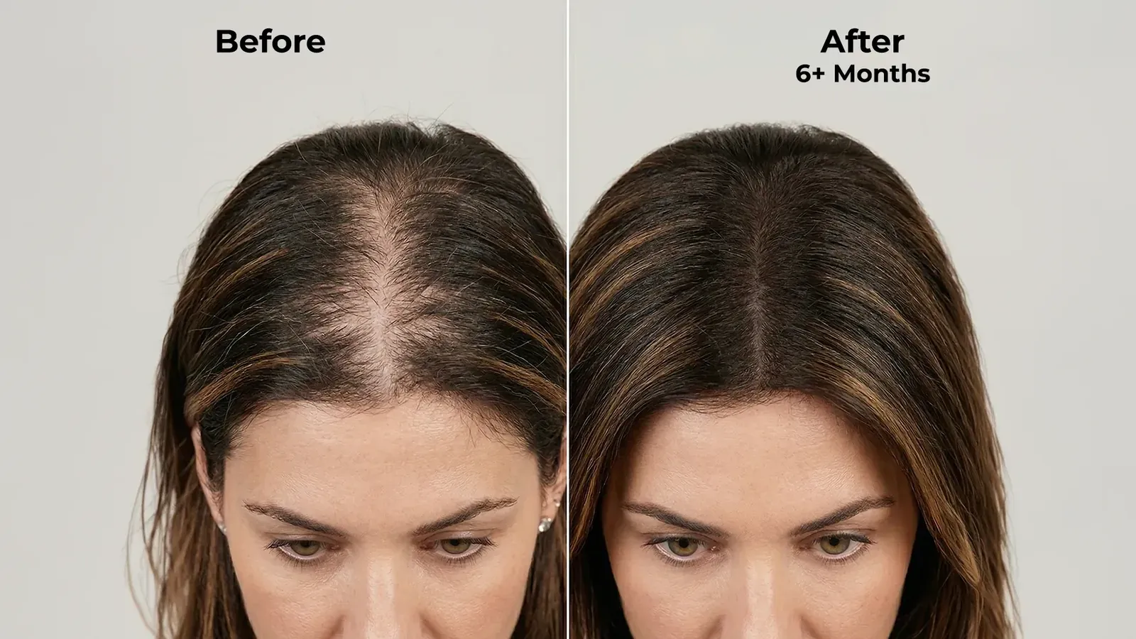 Ghori® Derma Roller banner on expected results when used consistently with Neo Hair Lotion