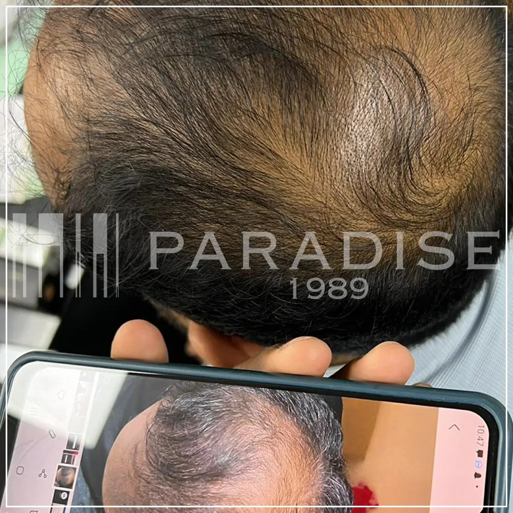 Verified customer photo review by Khalid S. for Green Wealth Neo Hair products