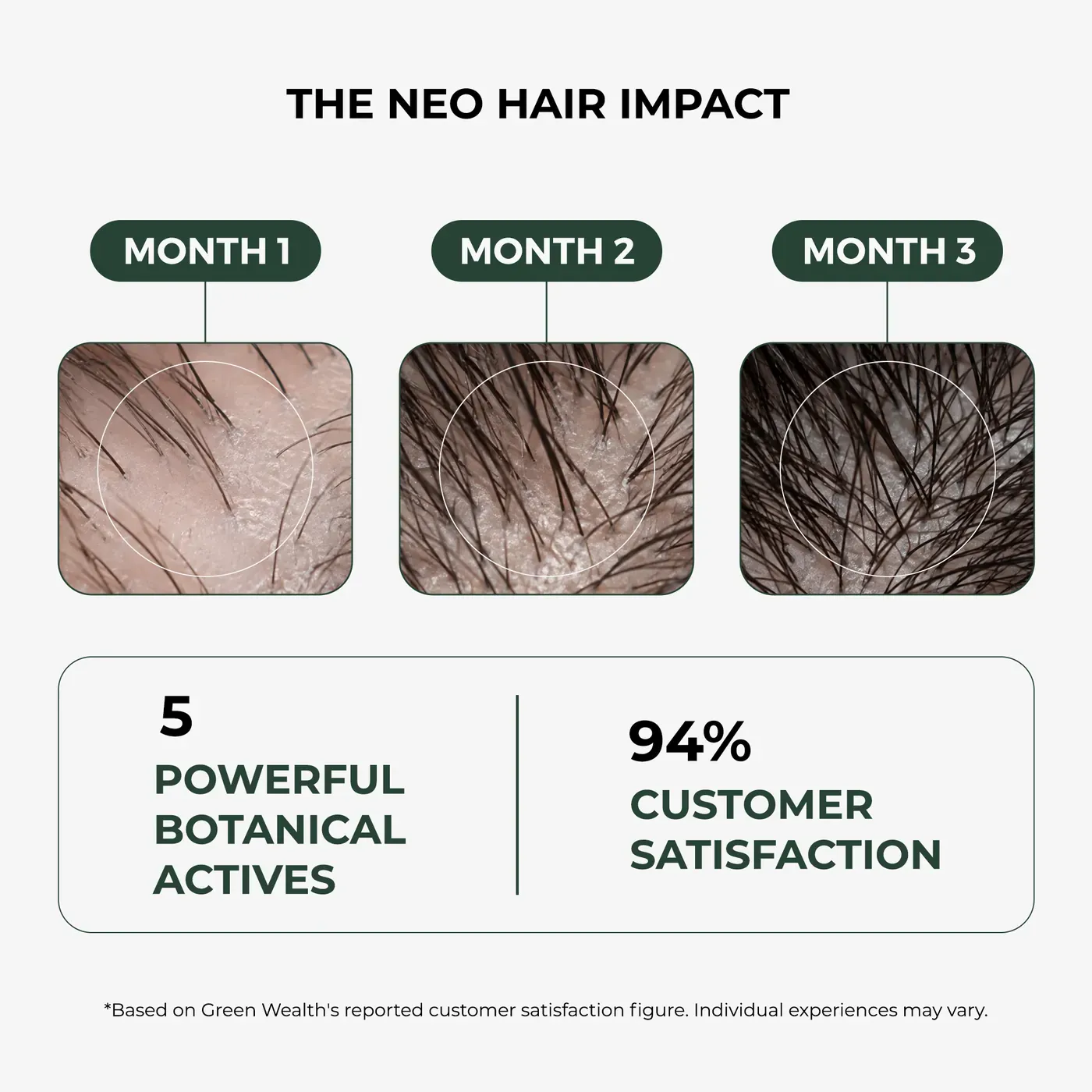 Neo Hair Lotion shown with the Ghori dermaroller and shampoo as the complete hair-growth routine